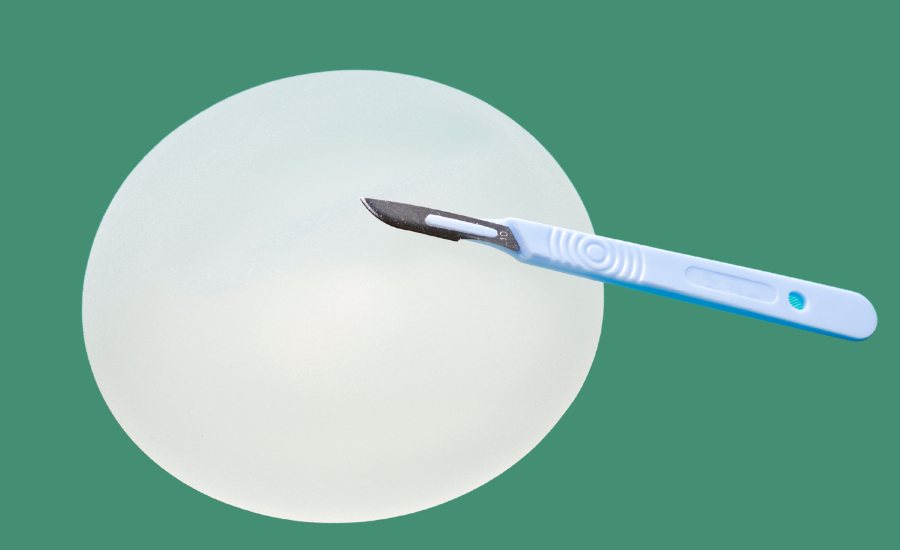Jak dobrać rozmiar implantów piersi? 5 cennych wskazówek