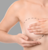 Metoda rekonstrukcji piersi z zastosowaniem tkanek własnych-tkanka tłuszczowa
