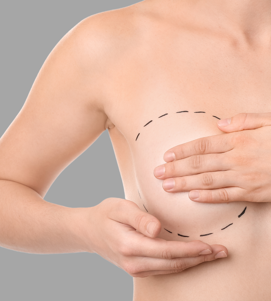 Metoda rekonstrukcji piersi z zastosowaniem tkanek własnych-tkanka tłuszczowa