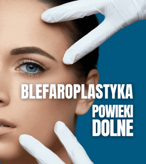 Blefaroplastyka powiek dolnych – chirurgiczna precyzja według Agnieszki Bielarskiej