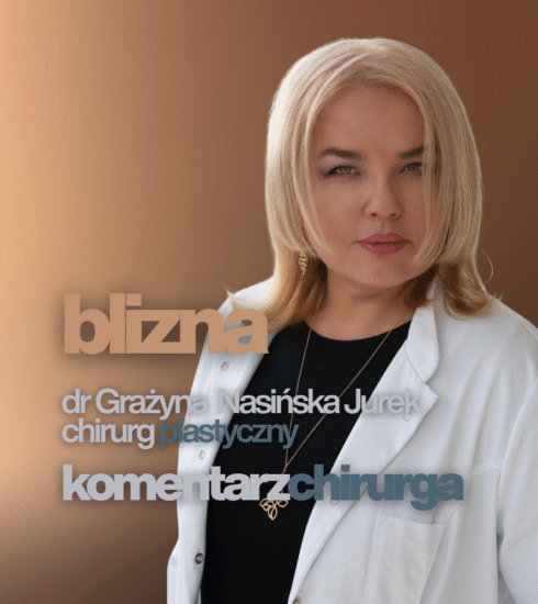 Czy blizna jest dobrym mocnym podparciem dla tkanek?